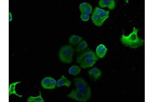Immunofluorescence staining of MCF-7 cells with ABIN7150498 at 1:133, counter-stained with DAPI.
