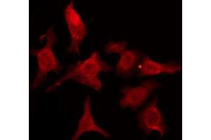 ABIN6274599 staining HeLa by IF/ICC. (CDH18 anticorps  (N-Term))