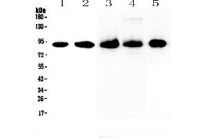 Western blot analysis of CD44 using anti-CD44 antibody .