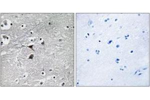 Immunohistochemistry analysis of paraffin-embedded human brain tissue, using Tryptophan Hydroxylase (Ab-260) Antibody.