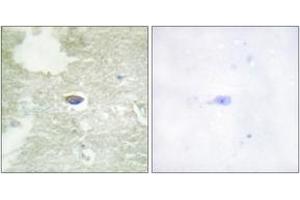 Immunohistochemistry analysis of paraffin-embedded human brain, using TGF beta Receptor II (Phospho-Ser225/250) Antibody. (TGFBR2 anticorps  (pSer225))