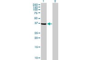 Western Blot analysis of TSSK2 expression in transfected 293T cell line by TSSK2 MaxPab polyclonal antibody. (TSSK2 anticorps  (AA 1-358))