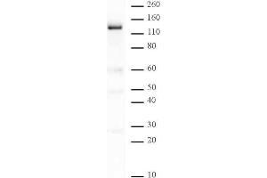 PARP-1 N-terminal antibody tested by Western blot.