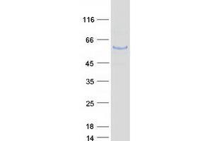 Validation with Western Blot