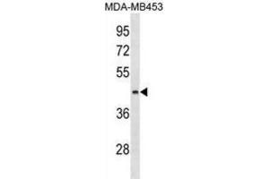 Western Blotting (WB) image for anti-Asparagine-Linked Glycosylation 8, alpha-1,3-Glucosyltransferase Homolog (ALG8) antibody (ABIN3000312) (ALG8 anticorps)