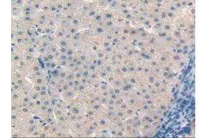 IHC-P analysis of Human Liver Tissue, with DAB staining. (Retinol Binding Protein 5 anticorps  (AA 2-135))