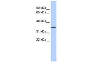Image no. 1 for anti-F-Box Protein 31 (FBXO31) (AA 431-480) antibody (ABIN6743760) (FBXO31 anticorps  (AA 431-480))