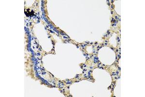 Immunohistochemistry of paraffin-embedded rat lung using IL36G antibody at dilution of 1:100 (40x lens). (IL1F9 anticorps)