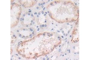 IHC-P analysis of Human Tissue, with DAB staining. (IL1A anticorps  (AA 113-271))