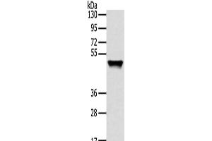 Western Blot analysis of Human fetal liver tissue using TRIM14 Polyclonal Antibody at dilution of 1/800 (TRIM14 anticorps)