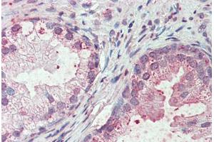 Anti-SLC44A2 antibody  ABIN960812 IHC staining of human prostate. (SLC44A2 anticorps  (Internal Region))