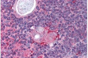 Human Thymus (formalin-fixed, paraffin-embedded) stained with IKBKB antibody ABIN297183 at 2. (IKBKB anticorps  (AA 310-376))