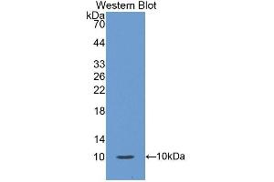 Detection of Recombinant S100A12, Human using Polyclonal Antibody to S100 Calcium Binding Protein A12 (S100A12)