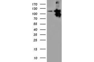 Western Blotting (WB) image for anti-Microtubule Associated Monoxygenase, Calponin and LIM Domain Containing 1 (MICAL1) antibody (ABIN1499468) (MICAL1 anticorps)