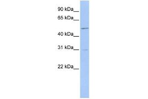 WB Suggested Anti-ERMAP Antibody Titration:  0. (ERMAP anticorps  (Middle Region))