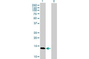 Western Blot analysis of GBA3 expression in transfected 293T cell line by GBA3 MaxPab polyclonal antibody. (GBA3 anticorps  (AA 1-162))