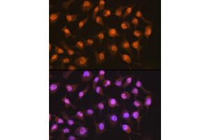 Immunofluorescence analysis of HeLa cells using PER2 Rabbit mAb (ABIN7269224) at dilution of 1:100 (40x lens).