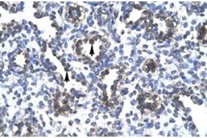 Immunohistochemical staining (Formalin-fixed paraffin-embedded sections) of human lung with FOXA3 polyclonal antibody  at 4-8 ug/mL working concentration. (FOXA3 anticorps  (Internal Region))