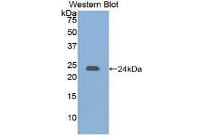 Western Blotting (WB) image for anti-Collagen, Type XVIII (COL18) (AA 1572-1754) antibody (ABIN1858449) (COL18 anticorps  (AA 1572-1754))