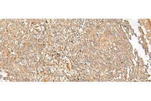 anti-Fibrinogen-Like 2 (FGL2) antibody