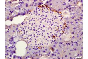 Formalin-fixed and paraffin embedded rat pancreas labeled with Anti-SPINK1 Polyclonal Antibody, Unconjugated (ABIN681658) at 1:200 followed by conjugation to the secondary antibody and DAB staining