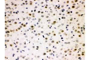Anti- Cdc25B Picoband antibody, IHC(P) IHC(P): Rat Brain Tissue (CDC25B anticorps  (AA 119-248))