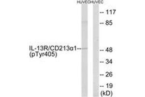 Western blot analysis of extracts from HuvEc cells treated with serum 20% 15', using IL-13R alpha1 (Phospho-Tyr405) Antibody. (IL13 Receptor alpha 1 anticorps  (pTyr405))