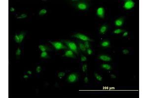 Immunofluorescence of monoclonal antibody to CAPG on HeLa cell. (CAPG anticorps  (AA 1-348))