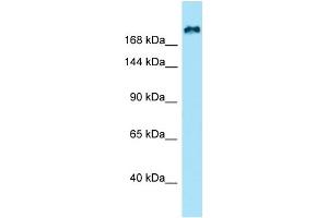 WB Suggested Anti-KIF21B Antibody Titration: 1. (KIF21B anticorps  (N-Term))