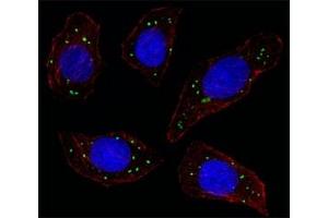 Fluorescent image of U251 cell stained with MERTK antibody at 1:25. (MERTK anticorps)