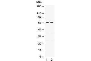 Western blot testing of human 1) A431 and 2) A549 lysate with Involucrin antibody.
