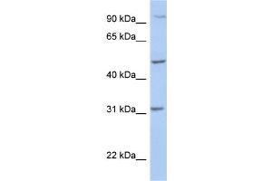 WB Suggested Anti-PPM1J Antibody Titration: 0. (PPM1J anticorps  (C-Term))