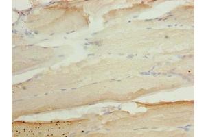 Immunohistochemistry of paraffin-embedded human skeletal muscle tissue using ABIN7144572 at dilution of 1:100