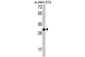 Image no. 1 for anti-Four and A Half LIM Domains 1 (FHL1) (C-Term) antibody (ABIN453000) (FHL1 anticorps  (C-Term))