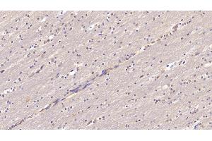 Detection of CHEM in Human Cerebrum Tissue using Monoclonal Antibody to Chemerin (CHEM) (CHEM (AA 33-158) anticorps)