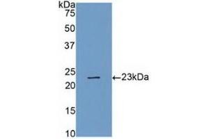 Detection of Recombinant CASP4, Human using Polyclonal Antibody to Caspase 4 (CASP4) (Caspase 4 anticorps  (AA 78-265))