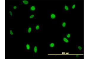 Immunofluorescence of monoclonal antibody to MPG on HeLa cell. (MPG anticorps  (AA 1-90))