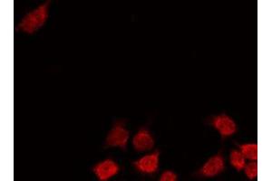 ABIN6269258 staining 293 by IF/ICC. (GATA4 anticorps  (Internal Region))