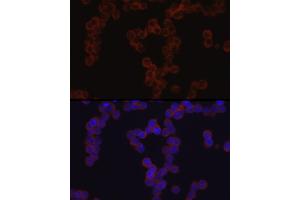 Immunofluorescence analysis of Y79 cells using TGF beta induced (TGFBI) Rabbit pAb (ABIN3023372, ABIN3023373, ABIN3023374 and ABIN6219663) at dilution of 1:50 (40x lens).