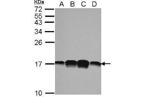 WB Image Sample (30 ug of whole cell lysate) A: 293T B: A431 C: HeLa D: HepG2 15% SDS PAGE antibody diluted at 1:1000 (PFN1 anticorps)