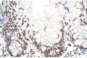 Rabbit Anti-ZNF394 Antibody Catalog Number: ARP30072 Paraffin Embedded Tissue: Human Intestine Cellular Data: Epithelial cells of intestinal villas Antibody Concentration: 4. (ZNF394 anticorps  (N-Term))