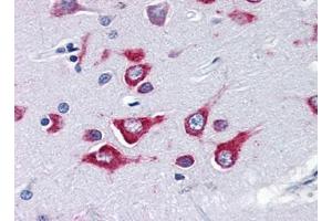 Image no. 3 for anti-Kinesin Family Member 5A (KIF5A) (Center) antibody (ABIN372915)