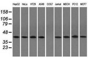 Image no. 2 for anti-Acetyl-CoA Acetyltransferase 2 (ACAT2) antibody (ABIN1496401) (ACAT2 anticorps)