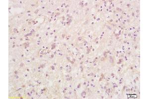 Formalin-fixed and paraffin embedded rat brain tissue labeled with Anti-Phospho-Caspase-9 (Thr125) Polyclonal Antibody, Unconjugated (ABIN683863) at 1:200 followed by conjugation to the secondary antibody and DAB staining (Caspase 9 anticorps  (pThr125))