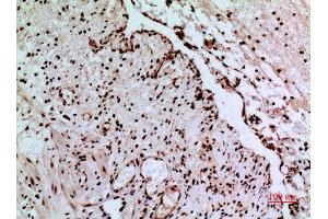 Immunohistochemistry (IHC) analysis of paraffin-embedded Human Colon, antibody was diluted at 1:100.