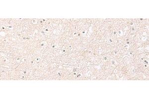 Immunohistochemistry of paraffin-embedded Human brain tissue using FGFR4 Polyclonal Antibody at dilution of 1:25(x200) (FGFR4 anticorps)