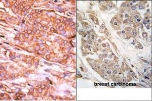 Image no. 2 for anti-CTD (Carboxy-terminal Domain, RNA Polymerase II, Polypeptide A) Small Phosphatase 2 (CTDSP2) (N-Term) antibody (ABIN360802)