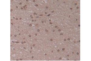 IHC-P analysis of Human Brain Tissue, with DAB staining. (ENPP2 anticorps  (AA 637-905))