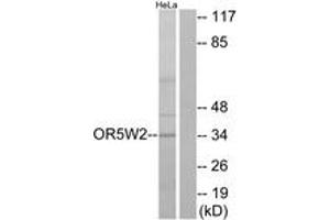 Western blot analysis of extracts from HeLa cells, using OR5W2 Antibody. (OR5W2 anticorps  (AA 158-207))