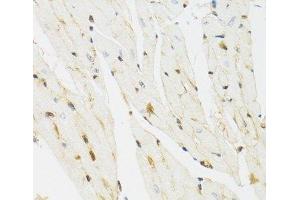 Immunohistochemistry of paraffin-embedded Mouse heart using THAP1 Polyclonal Antibody at dilution of 1:100 (40x lens). (THAP1 anticorps)